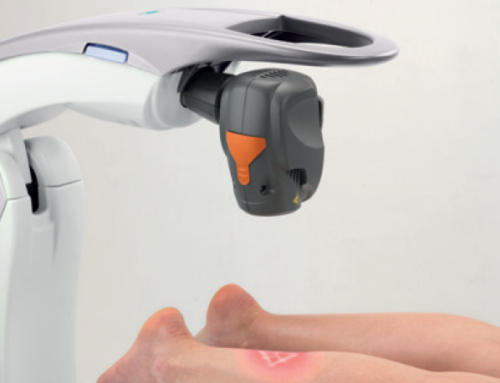 Jak funguje léčba nohou pomocí laserové terapie